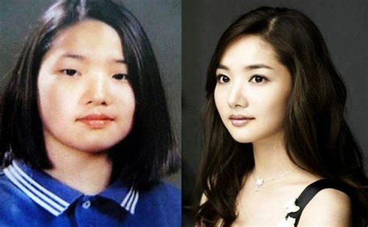 Park Min Young's Pre-Surgery Journey